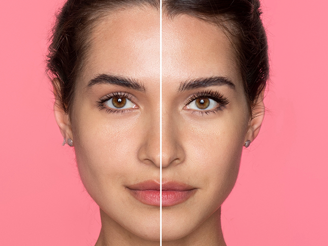 Asymmetry of the face