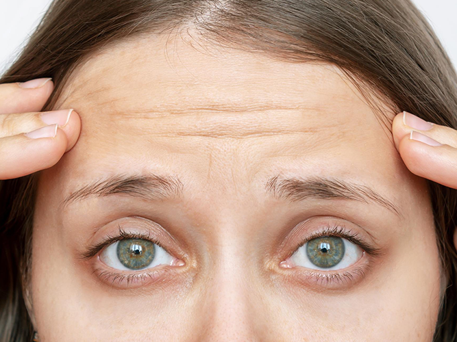 Fine Lines and Wrinkles